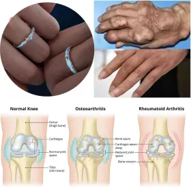 313036744702 DIOWUS Lymphatic Magtherapy Luminous Ring Men #3