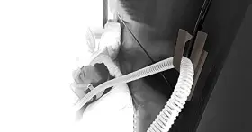 7480227922016 OTEN MEDICAL Cpap Hose Holder Mocha